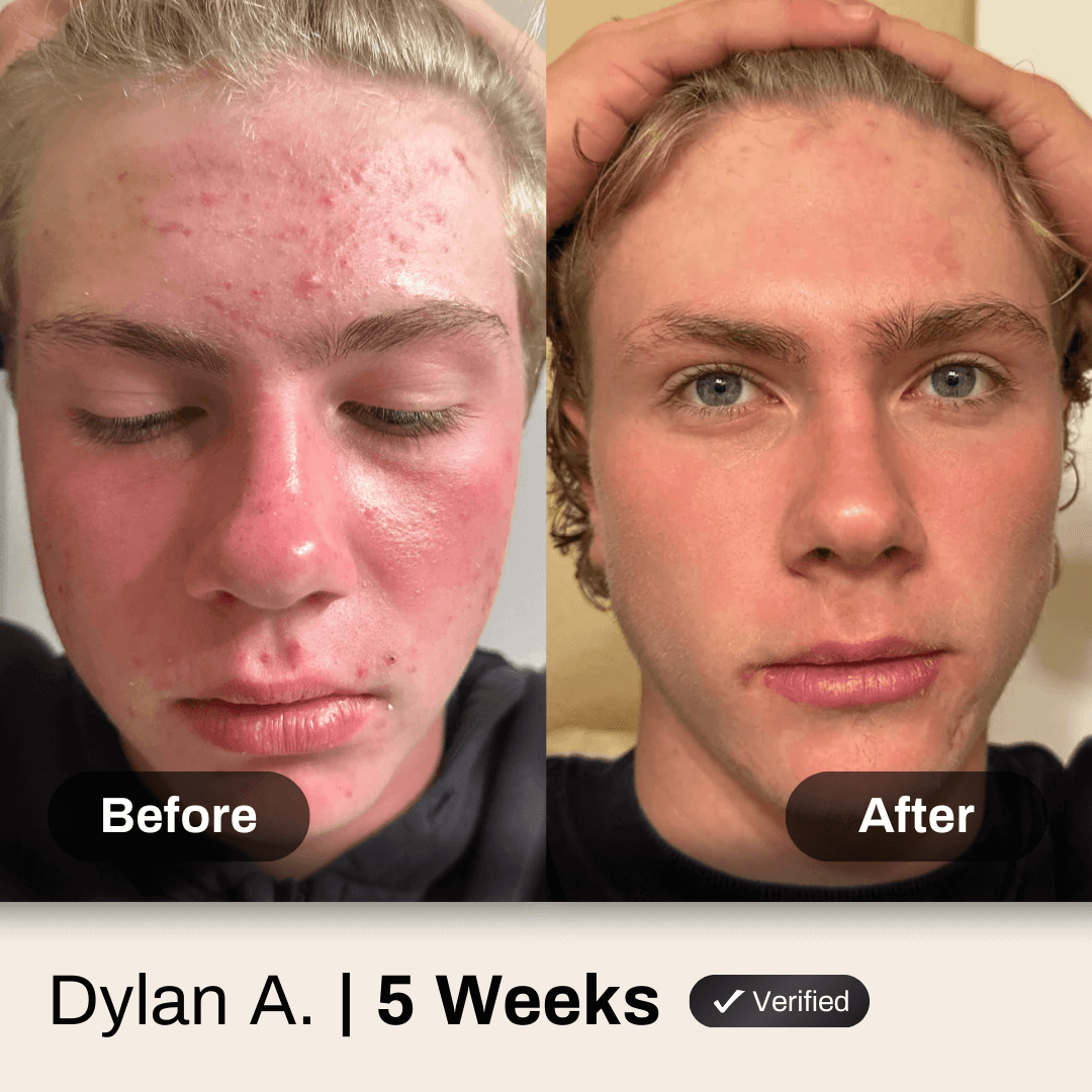 Face & Body System