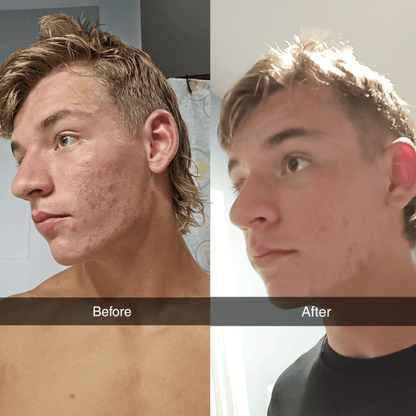 Shield Labs Face Wash