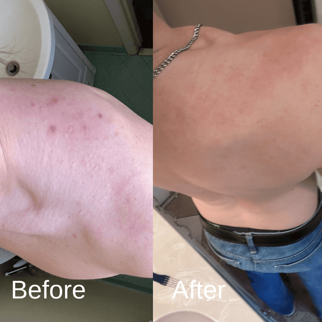 Shield Labs Body Acne Wash