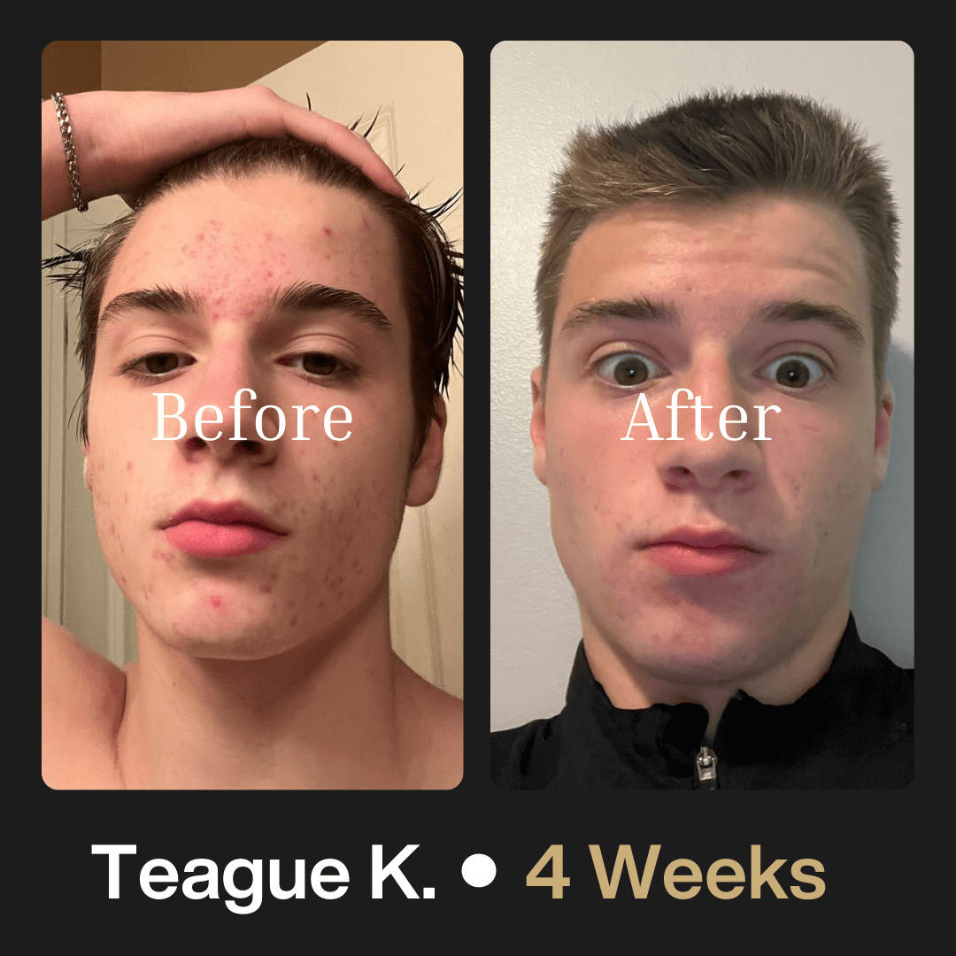 Advanced Face System