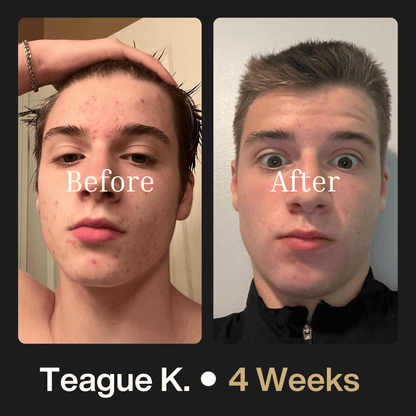 Advanced Face System