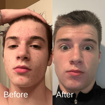 Shield Labs Face Wash
