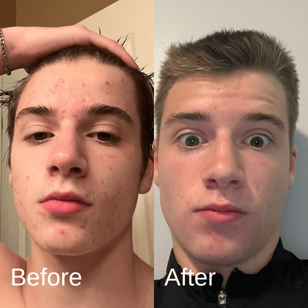 Shield Labs Face Wash