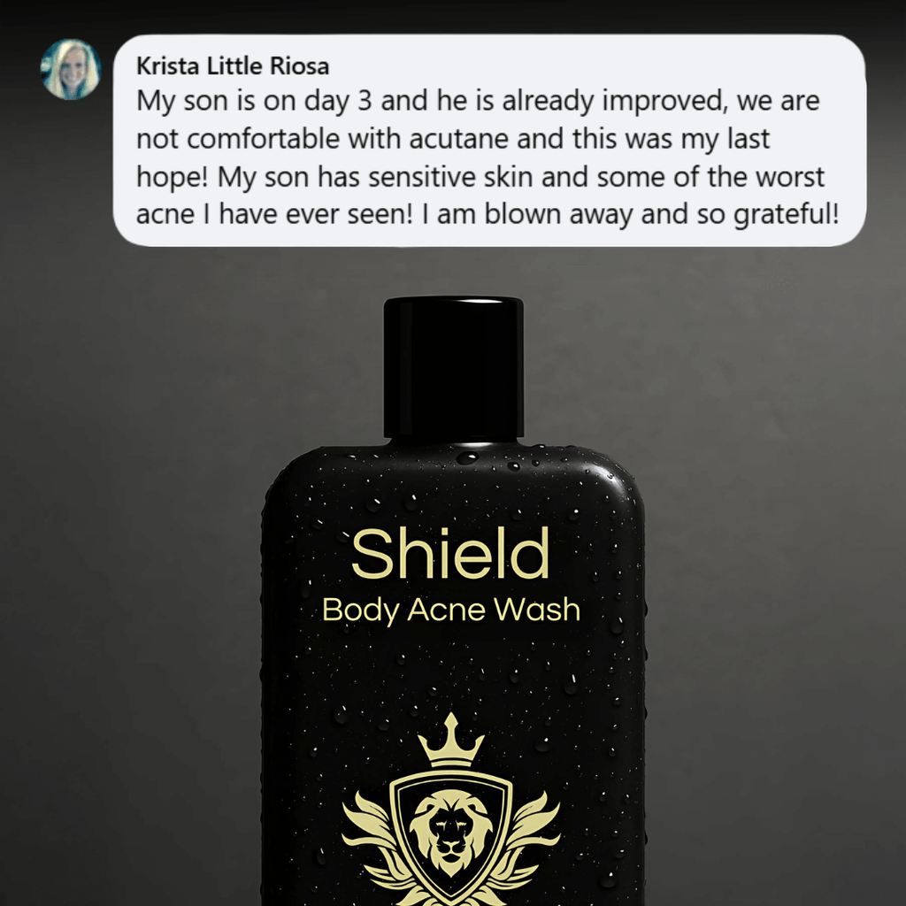 Shield Labs Body Acne Wash